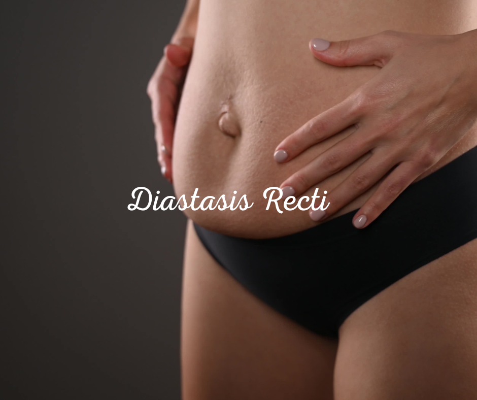 Post Natal Diastasis Recti Assessment My Bodyworks