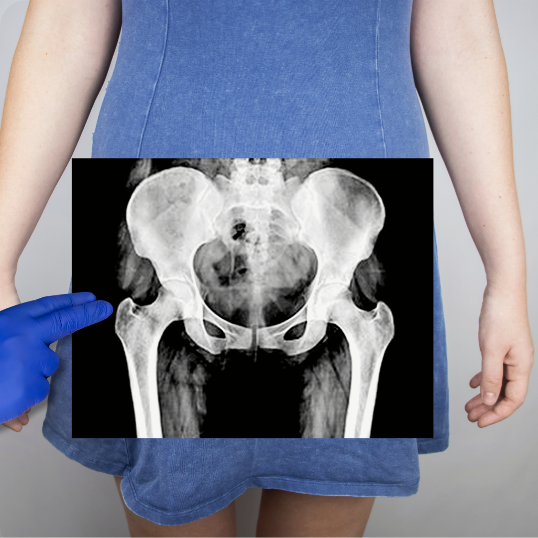 pelvic health
